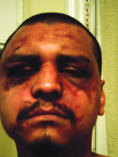 Gabriel Carrillo was beaten by deputies while visiting his brother in Men's Central Jail.
