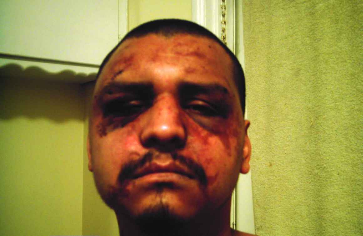 Gabriel Carrillo was beaten by deputies while visiting his brother in Men's Central Jail.