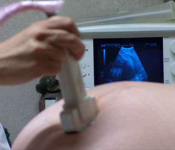 Foreground: pregnant belly and an ultrasound wand. Background: An ultrasound image on screen.